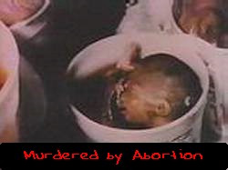 aborted baby